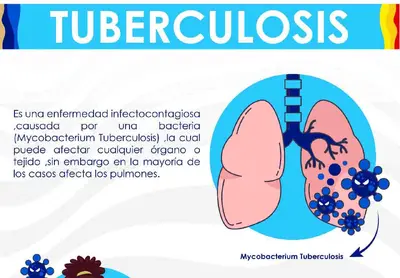 Aquí te enséñanos la definición de Tuberculosis